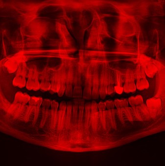 [Kép: MjMxMDIzNw.jpg]